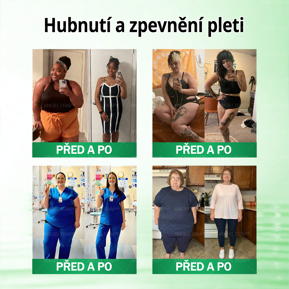Oficiální prodejna  |  🧑‍⚕️ANGELTRAP® 𝐌𝐨𝐫𝐢𝐧𝐠𝐚 × 𝐁𝐞𝐫𝐛𝐞𝐫𝐲𝐧𝐚 × 𝐀𝐌𝐏𝐊 𝟏𝟎 v 1 – Zeštíhlující nano mikrojihlový náplast 🇨🇿 Jen 1× denně ✅ Viditelné změny za 7 dní – na obezitu, kardiovaskulární zdraví, diabetes a kloubní problémy💙💙💙