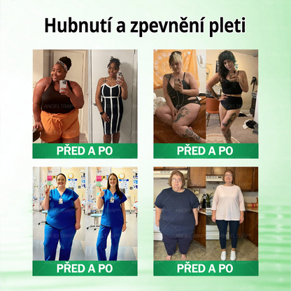 Oficiální prodejna  |  🧑‍⚕️ANGELTRAP® 𝐌𝐨𝐫𝐢𝐧𝐠𝐚 × 𝐁𝐞𝐫𝐛𝐞𝐫𝐲𝐧𝐚 × 𝐀𝐌𝐏𝐊 𝟏𝟎 v 1 – Zeštíhlující nano mikrojihlový náplast 🇨🇿 Jen 1× denně ✅ Viditelné změny za 7 dní – na obezitu, kardiovaskulární zdraví, diabetes a kloubní problémy💙💙💙